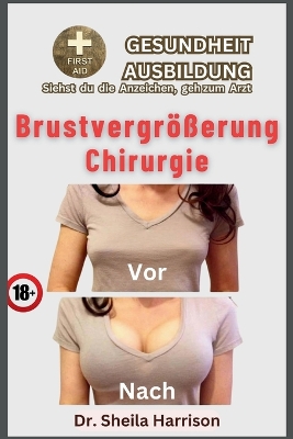 Book cover for Brustvergrößerung Chirurgie