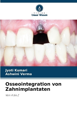 Cover of Osseointegration von Zahnimplantaten