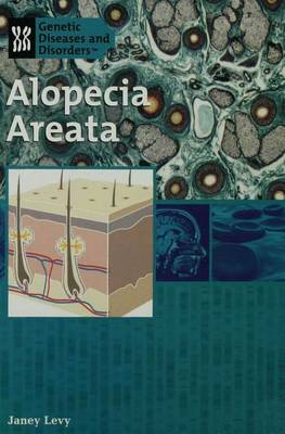 Book cover for Alopecia Areata