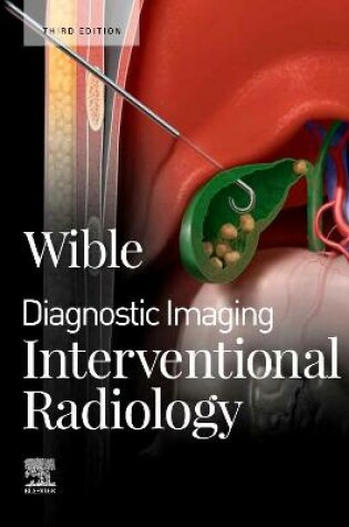 Cover of Interventional Radiology E-Book