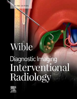 Cover of Interventional Radiology E-Book