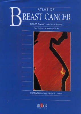 Book cover for Atlas of Breast Cancer