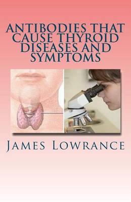 Book cover for Antibodies that Cause Thyroid Diseases and Symptoms