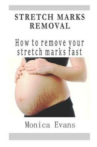 Cover of Stretch Marks Removal