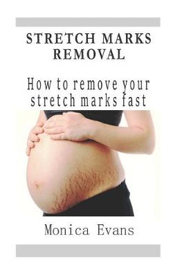 Book cover for Stretch Marks Removal