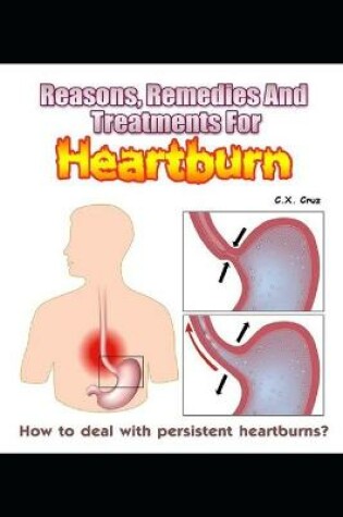 Cover of Reasons, Remedies And Treatments For Heartburns