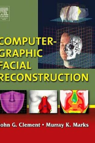 Computer-Graphic Facial Reconstruction