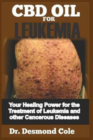 Cover of CBD Oil for Leukemia