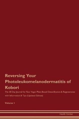 Cover of Reversing Your Photoleukomelanodermatitis of Kobori