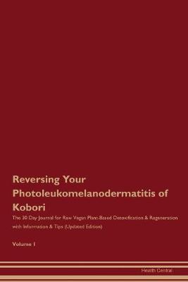 Book cover for Reversing Your Photoleukomelanodermatitis of Kobori