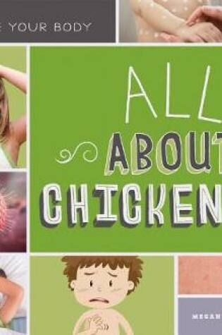 Cover of All about Chickenpox