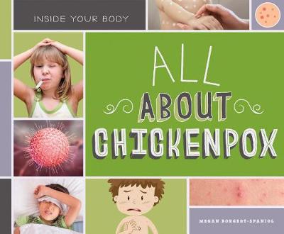 Book cover for All about Chickenpox