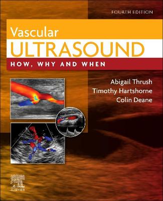 Book cover for Vascular Ultrasound E-Book