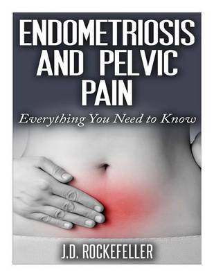 Book cover for Endometriosis and Pelvic Pain