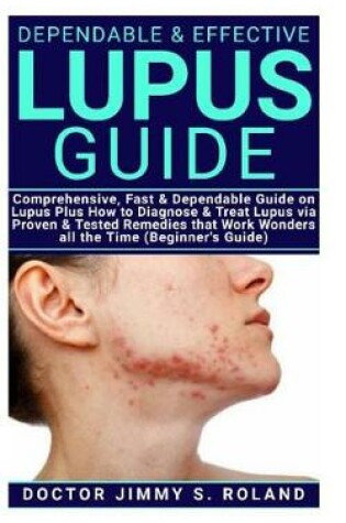 Cover of Dependable & Effective Lupus Guide