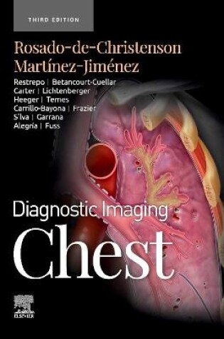 Cover of Chest - E-Book