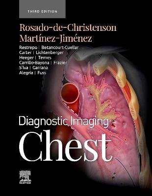 Book cover for Chest - E-Book