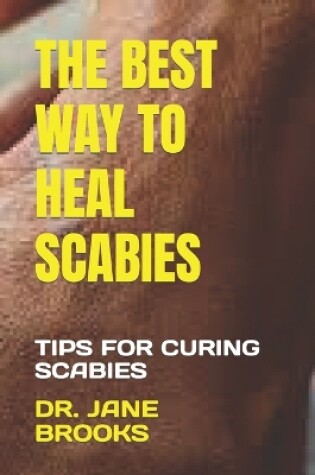 Cover of The Best Way to Heal Scabies