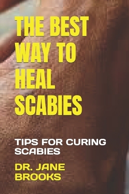 Book cover for The Best Way to Heal Scabies