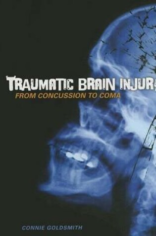 Cover of Traumatic Brain Injury: From Concussion to Coma