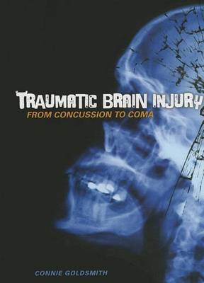 Book cover for Traumatic Brain Injury: From Concussion to Coma