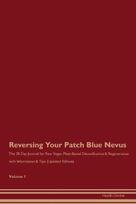 Book cover for Reversing Your Patch Blue Nevus