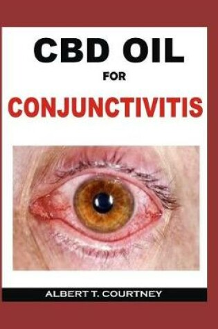 Cover of CBD Oil for Conjunctivitis