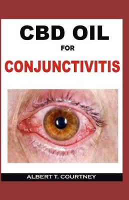 Book cover for CBD Oil for Conjunctivitis