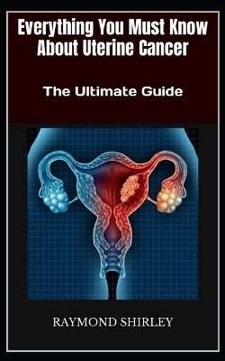 Book cover for Everything You Must Know About Uterine Cancer