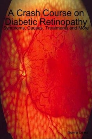 Cover of A Crash Course on Diabetic Retinopathy: Symptoms, Causes, Treatments and More