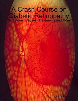 Book cover for A Crash Course on Diabetic Retinopathy: Symptoms, Causes, Treatments and More