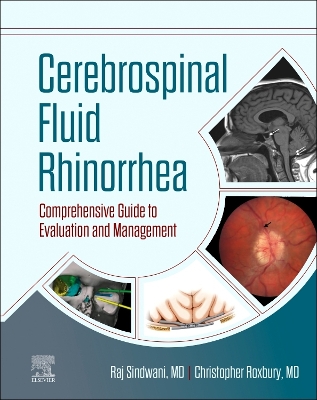 Cover of Cerebrospinal Fluid Rhinorrhea - E-Book