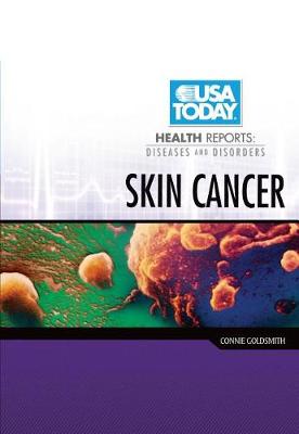 Book cover for Skin Cancer