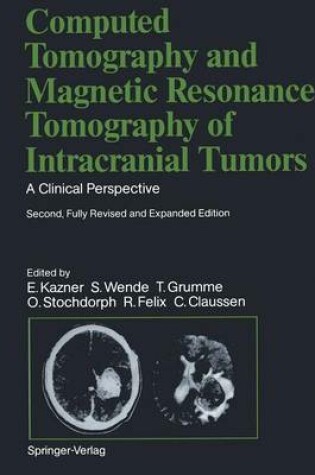 Cover of Computed Tomography and Magnetic Resonance Tomography of Intracranial Tumors