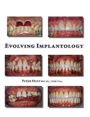 Book cover for Evolving Implantology