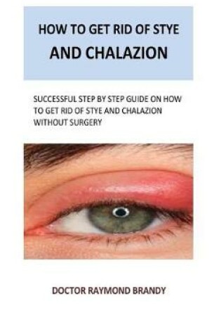 Cover of How to get rid of stye and chalazion