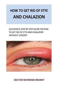 Book cover for How to get rid of stye and chalazion