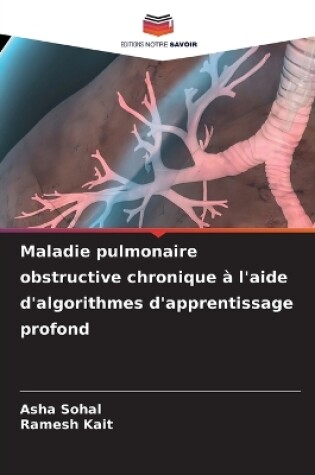 Cover of Maladie pulmonaire obstructive chronique � l'aide d'algorithmes d'apprentissage profond