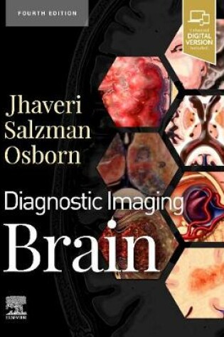 Cover of Diagnostic Imaging: Brain