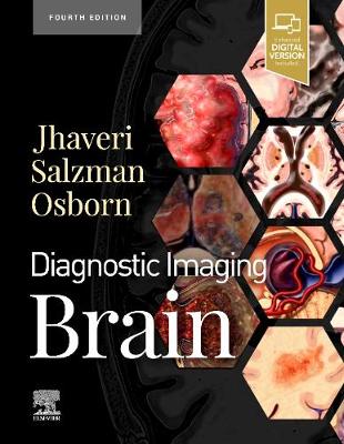 Book cover for Diagnostic Imaging: Brain