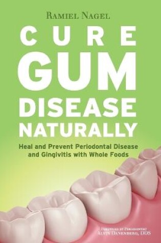 Cover of Cure Gum Disease Naturally