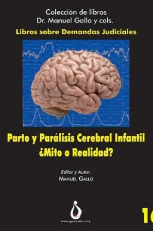 Cover of Parto Y Paralisis Cerebral Infantil. ?mito O Realidad?