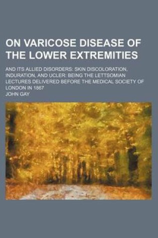 Cover of On Varicose Disease of the Lower Extremities; And Its Allied Disorders Skin Discoloration, Induration, and Ucler Being the Lettsomian Lectures Delivered Before the Medical Society of London in 1867