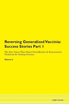 Book cover for Reversing Generalized Vaccinia