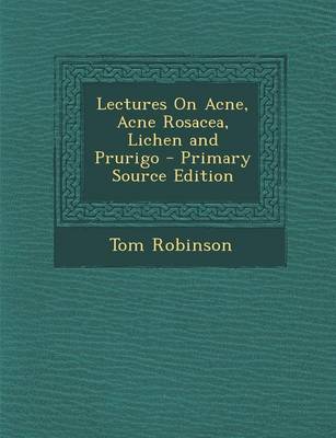 Book cover for Lectures on Acne, Acne Rosacea, Lichen and Prurigo - Primary Source Edition