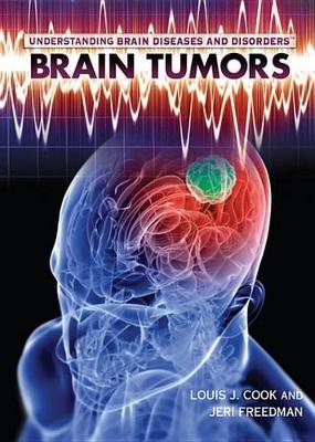 Book cover for Brain Tumors