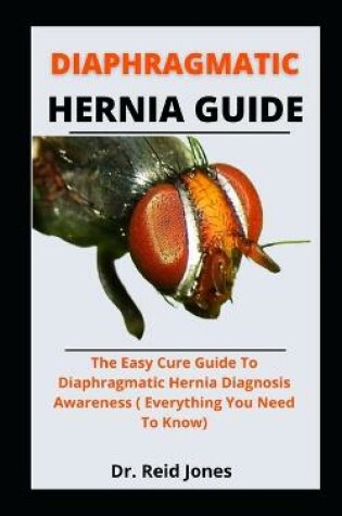 Cover of Diaphragmatic Hernia Guide