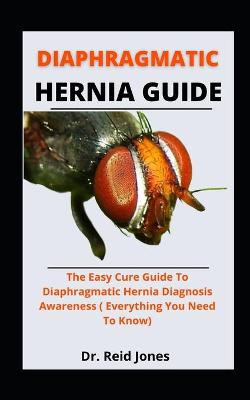 Book cover for Diaphragmatic Hernia Guide