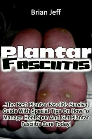 Cover of Plantar Fasciitis: The Best Plantar Fasciitis Survival Guide With Special Tips On How to Manage Heel Spur and Get Plantar Fasciitis Cure Today!