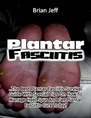Book cover for Plantar Fasciitis: The Best Plantar Fasciitis Survival Guide With Special Tips On How to Manage Heel Spur and Get Plantar Fasciitis Cure Today!